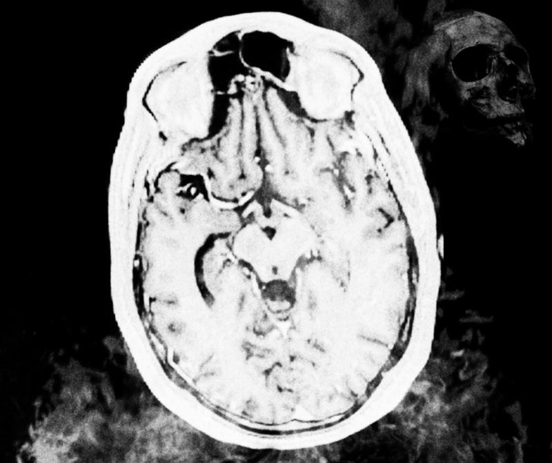 A Poem –&nbsp;Images